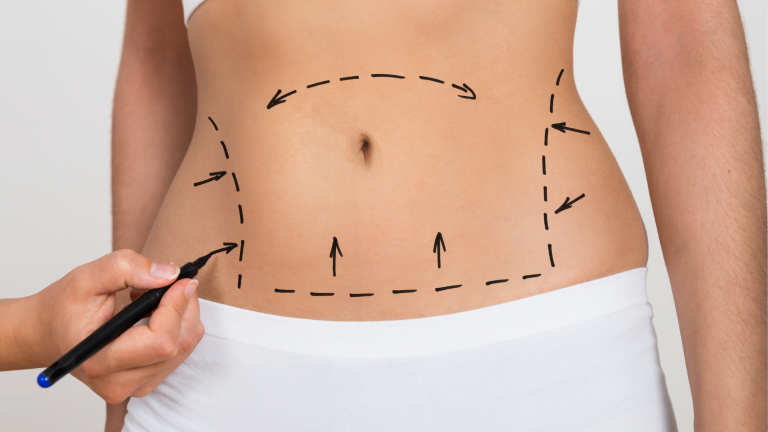 Chirurgie esthétique au Maroc: des pratiques peu admises